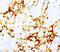 Tenascin N antibody, MA1094, Boster Biological Technology, Immunohistochemistry paraffin image 