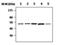 Receptor Interacting Serine/Threonine Kinase 2 antibody, MA5-17221, Invitrogen Antibodies, Western Blot image 