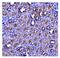 Eukaryotic Translation Termination Factor 1 antibody, M04157, Boster Biological Technology, Immunohistochemistry paraffin image 