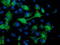 Mahogunin Ring Finger 1 antibody, LS-C785869, Lifespan Biosciences, Immunofluorescence image 