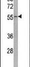 Ubiquitin Specific Peptidase 22 antibody, PA5-12027, Invitrogen Antibodies, Western Blot image 