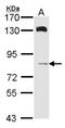 HPS6 Biogenesis Of Lysosomal Organelles Complex 2 Subunit 3 antibody, LS-C185904, Lifespan Biosciences, Western Blot image 