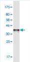 Serine Hydroxymethyltransferase 2 antibody, H00006472-M04-100ug, Novus Biologicals, Western Blot image 