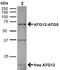 Autophagy Related 12 antibody, 23007, QED Bioscience, Western Blot image 