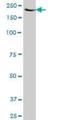 Ribosomal Protein S6 Kinase A5 antibody, H00009252-M01, Novus Biologicals, Western Blot image 