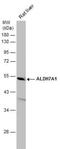 Aldehyde Dehydrogenase 7 Family Member A1 antibody, NBP2-15343, Novus Biologicals, Western Blot image 