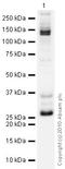 RAB5A, Member RAS Oncogene Family antibody, ab31261, Abcam, Western Blot image 