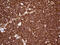 IQ Motif Containing GTPase Activating Protein 1 antibody, M01603-1, Boster Biological Technology, Immunohistochemistry paraffin image 