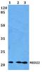 Mediator Complex Subunit 22 antibody, A10963, Boster Biological Technology, Western Blot image 