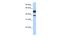 Lipase Family Member J antibody, A16312, Boster Biological Technology, Western Blot image 