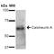 Calcineurin A antibody, PA5-77819, Invitrogen Antibodies, Western Blot image 