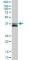 SGT1 Homolog, MIS12 Kinetochore Complex Assembly Cochaperone antibody, H00010910-B01P, Novus Biologicals, Western Blot image 