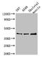 Beta-1,3-Galactosyltransferase 4 antibody, LS-C677265, Lifespan Biosciences, Western Blot image 