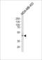 Interleukin 5 Receptor Subunit Alpha antibody, LS-C165211, Lifespan Biosciences, Western Blot image 