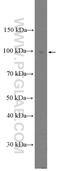 Calpain 3 antibody, 10415-1-AP, Proteintech Group, Western Blot image 