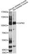 Calpain 3 antibody, STJ22883, St John