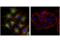 Melan-A antibody, 64718S, Cell Signaling Technology, Immunofluorescence image 