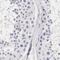 Ornithine Carbamoyltransferase antibody, PA5-51366, Invitrogen Antibodies, Immunohistochemistry frozen image 