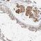 Tissue Specific Transplantation Antigen P35B antibody, NBP1-83408, Novus Biologicals, Immunohistochemistry frozen image 