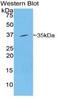 Spleen Associated Tyrosine Kinase antibody, MBS2002926, MyBioSource, Western Blot image 