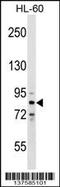 Zinc Finger Protein 224 antibody, 59-372, ProSci, Western Blot image 
