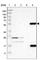 Flavin Containing Dimethylaniline Monoxygenase 3 antibody, HPA013750, Atlas Antibodies, Western Blot image 