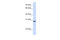 Troponin T3, Fast Skeletal Type antibody, 26-597, ProSci, Enzyme Linked Immunosorbent Assay image 