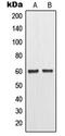 Matrix Metallopeptidase 11 antibody, MBS820150, MyBioSource, Western Blot image 