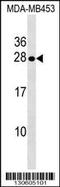 Serine Peptidase Inhibitor, Kunitz Type 2 antibody, 60-423, ProSci, Western Blot image 