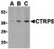 C1q And TNF Related 5 antibody, PA5-20153, Invitrogen Antibodies, Western Blot image 