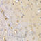 Secreted frizzled-related protein 2 antibody, LS-C346077, Lifespan Biosciences, Immunohistochemistry paraffin image 