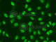 Checkpoint Kinase 2 antibody, A2145, ABclonal Technology, Immunofluorescence image 