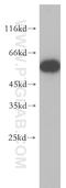 Phenylalanyl-TRNA Synthetase Subunit Alpha antibody, 18121-1-AP, Proteintech Group, Western Blot image 