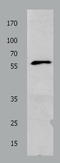 Potassium Voltage-Gated Channel Subfamily C Member 1 antibody, TA322686, Origene, Western Blot image 