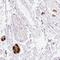 Peripherin antibody, HPA039277, Atlas Antibodies, Immunohistochemistry frozen image 