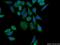 Histidine Rich Calcium Binding Protein antibody, 18142-1-AP, Proteintech Group, Immunofluorescence image 