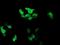 RAB37, Member RAS Oncogene Family antibody, NBP2-45926, Novus Biologicals, Immunofluorescence image 