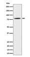 CREB Regulated Transcription Coactivator 2 antibody, M01118-1, Boster Biological Technology, Western Blot image 