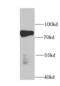 Poly(A) Binding Protein Cytoplasmic 4 antibody, FNab06098, FineTest, Western Blot image 