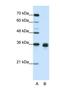 Wnt Family Member 2B antibody, NBP1-53120, Novus Biologicals, Western Blot image 