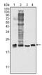 Superoxide Dismutase 1 antibody, AM06340SU-N, Origene, Western Blot image 