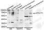 Activating Transcription Factor 2 antibody, AP0020, ABclonal Technology, Western Blot image 