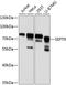 Septin 9 antibody, 23-699, ProSci, Western Blot image 