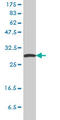 Stratifin antibody, LS-B4334, Lifespan Biosciences, Western Blot image 