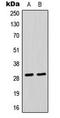 Chloride Intracellular Channel 4 antibody, LS-C354165, Lifespan Biosciences, Western Blot image 