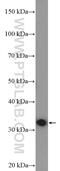 Protein Phosphatase 1 Regulatory Inhibitor Subunit 1B antibody, 10748-1-AP, Proteintech Group, Western Blot image 