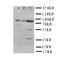 Phosphoinositide-3-Kinase Regulatory Subunit 2 antibody, orb76194, Biorbyt, Western Blot image 