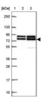 DEAD-Box Helicase 17 antibody, NBP2-38985, Novus Biologicals, Western Blot image 