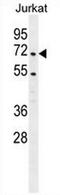 Coactivator Associated Arginine Methyltransferase 1 antibody, AP53448PU-N, Origene, Western Blot image 