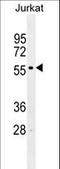 Interferon Regulatory Factor 2 antibody, LS-C165288, Lifespan Biosciences, Western Blot image 